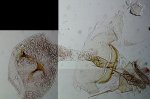 Gypsonoma aceriana femelle AC-7596 {JPEG}