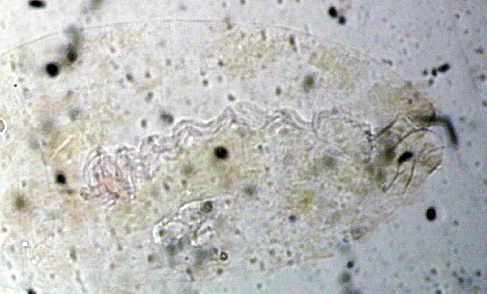61_245199_Stigmella hybnerella genitalia femelle